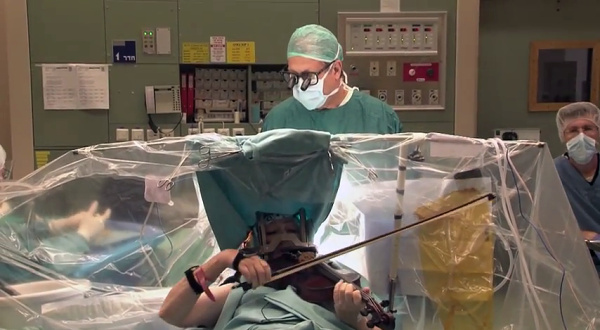 В Израиле скрипачка играла во время операции на ее мозге - фото